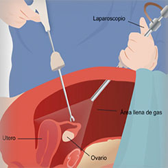 loading image